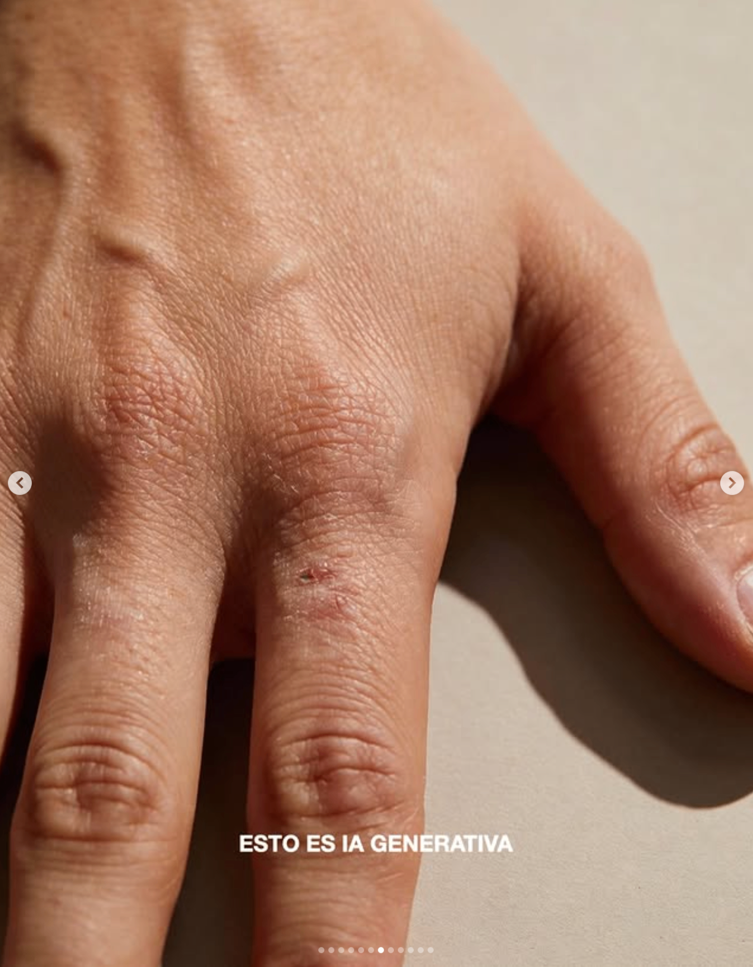Primer plano hiperrealista de una mano generada por IA — venas, arrugas y una pequeña herida en el nudillo.